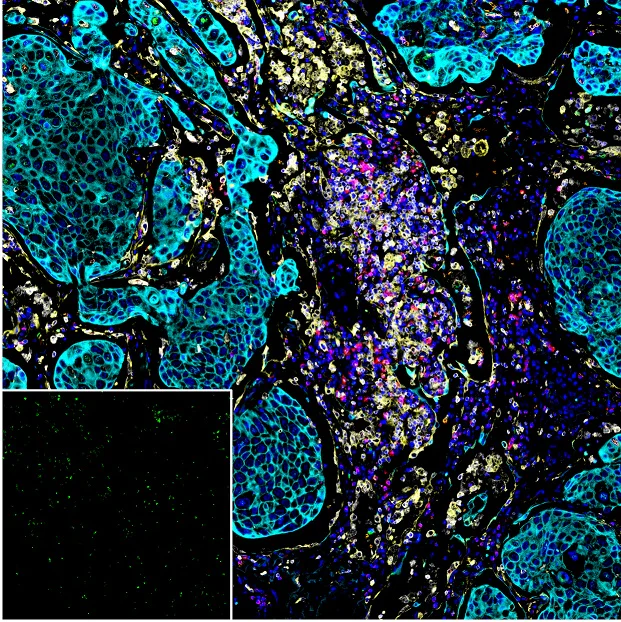 Multiplex immunohistochemistry - Anti-HLA-DR antibody [EPR3692] - BSA and Azide free (AB209968)