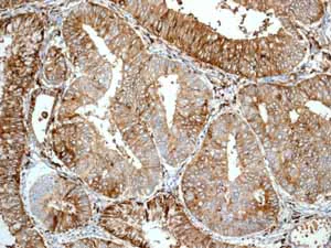 Immunohistochemistry (Formalin/PFA-fixed paraffin-embedded sections) - Anti-HLA-DR antibody [EPR3692] - Low endotoxin, Azide free (AB215985)