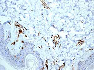Immunohistochemistry (Formalin/PFA-fixed paraffin-embedded sections) - Anti-HLA-DR antibody [EPR3692] - Low endotoxin, Azide free (ab215985), expandable thumbnail