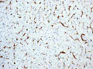 Immunohistochemistry (Formalin/PFA-fixed paraffin-embedded sections) - Anti-HLA-DR antibody [EPR3692] - Low endotoxin, Azide free (AB215985)