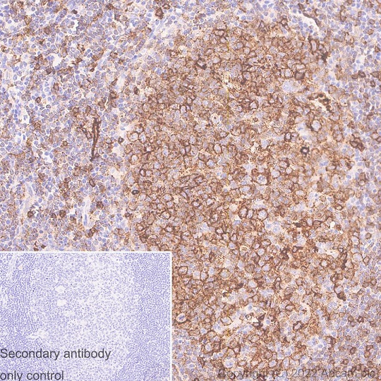 Immunohistochemistry (Formalin/PFA-fixed paraffin-embedded sections) - Anti-HLA-DR antibody [EPR3692] - Low endotoxin, Azide free (ab215985), expandable thumbnail