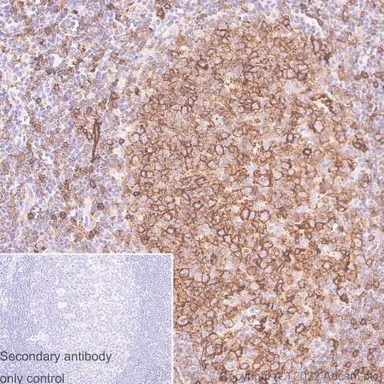 Immunohistochemistry (Formalin/PFA-fixed paraffin-embedded sections) - Anti-HLA-DR antibody [EPR3692] - Low endotoxin, Azide free (AB215985)