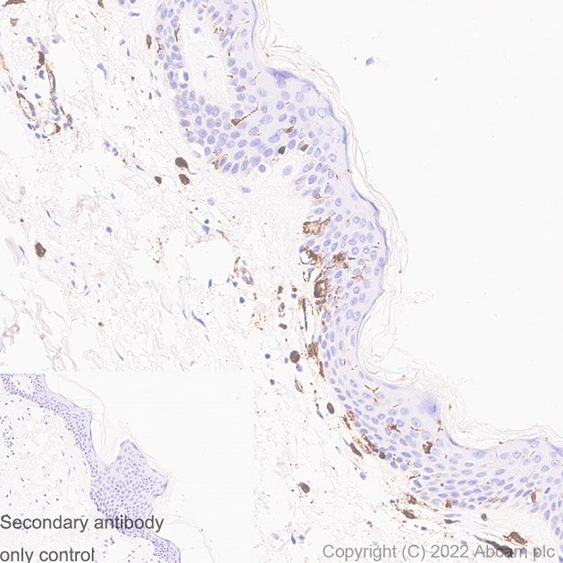 Immunohistochemistry (Formalin/PFA-fixed paraffin-embedded sections) - Anti-HLA-DR antibody [EPR3692] - Low endotoxin, Azide free (ab215985), expandable thumbnail