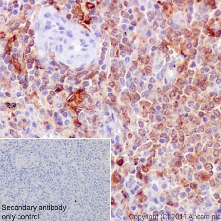 Immunohistochemistry (Formalin/PFA-fixed paraffin-embedded sections) - Anti-HLA-DR antibody [EPR3692] - Low endotoxin, Azide free (ab215985), expandable thumbnail