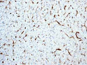 Immunohistochemistry (Formalin/PFA-fixed paraffin-embedded sections) - Anti-HLA-DR antibody [EPR3692] - Low endotoxin, Azide free (ab215985), expandable thumbnail