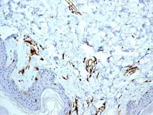 Immunohistochemistry (Formalin/PFA-fixed paraffin-embedded sections) - Anti-HLA-DR antibody [EPR3692] - Low endotoxin, Azide free (ab215985), expandable thumbnail