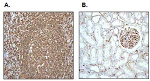Immunohistochemistry (Formalin/PFA-fixed paraffin-embedded sections) - Anti-HLA-DR antibody [EPR3692] - Low endotoxin, Azide free (ab215985), expandable thumbnail