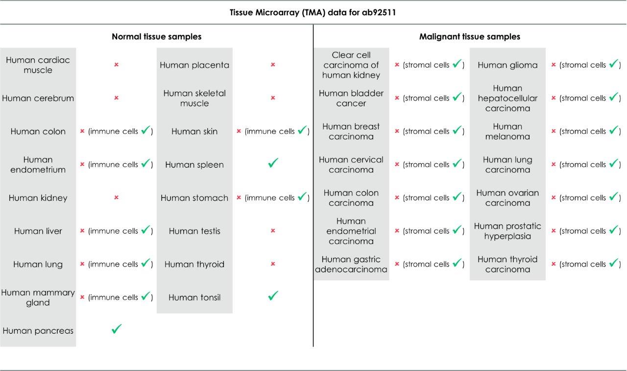Immunohistochemistry (Formalin/PFA-fixed paraffin-embedded sections) - Anti-HLA-DR antibody [EPR3692] - Low endotoxin, Azide free (ab215985), expandable thumbnail