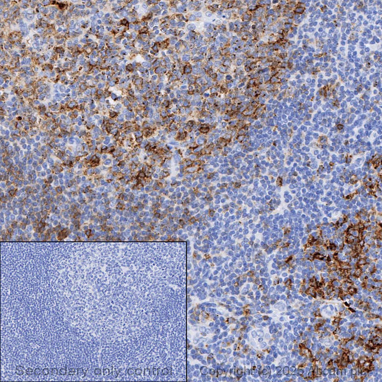 Immunohistochemistry (Formalin/PFA-fixed paraffin-embedded sections) - Anti-HLA-DR antibody [EPR3692] - Low endotoxin, Azide free (AB215985)