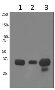 Western blot - Anti-HLA-DR antibody [EPR3692] - Low endotoxin, Azide free (AB215985)