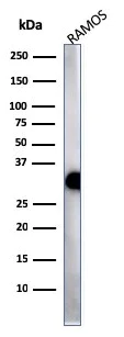 Western blot - Anti-HLA-DR antibody [HLA-Pan/2967R] (AB257320)