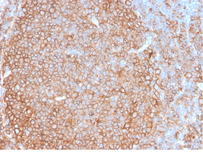 Immunohistochemistry (Formalin/PFA-fixed paraffin-embedded sections) - Anti-HLA-DR antibody [HLA-Pan/2967R] - BSA and Azide free (AB259258)