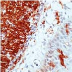 Immunohistochemistry (Formalin/PFA-fixed paraffin-embedded sections) - Anti-HLA-DR antibody [SPM289] (AB17844)