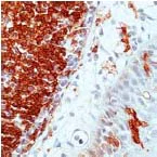 Immunohistochemistry (Formalin/PFA-fixed paraffin-embedded sections) - Anti-HLA-DR antibody [SPM289] (AB17844)