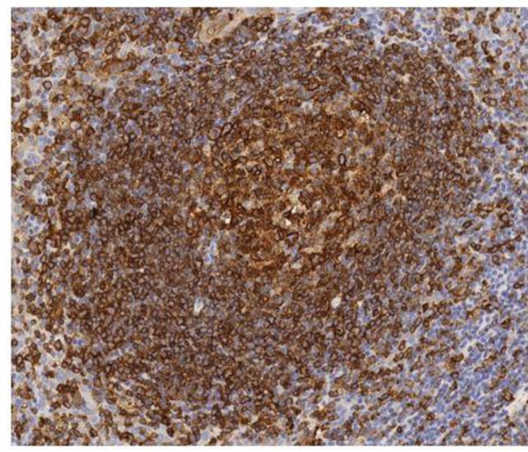 Immunohistochemistry (Formalin/PFA-fixed paraffin-embedded sections) - Anti-HLA-DR antibody [TAL 1B5] (AB20181), expandable thumbnail