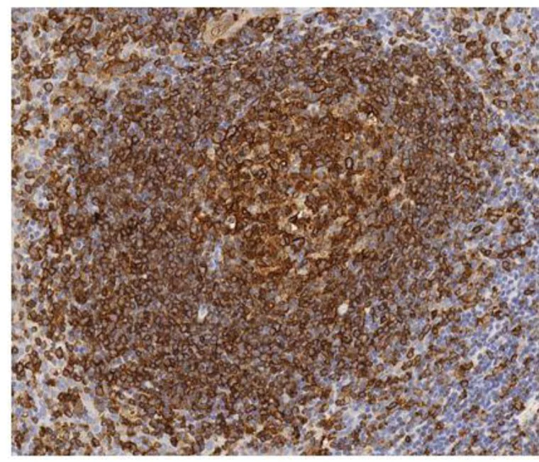 Immunohistochemistry (Formalin/PFA-fixed paraffin-embedded sections) - Anti-HLA-DR antibody [TAL 1B5] (AB20181)