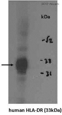 Western blot - Anti-HLA-DR antibody [TAL 1B5] (AB20181)