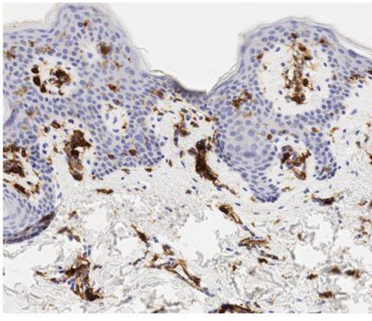 Immunohistochemistry (Formalin/PFA-fixed paraffin-embedded sections) - Anti-HLA-DR antibody [TAL 1B5] - BSA and Azide free (AB176408), expandable thumbnail