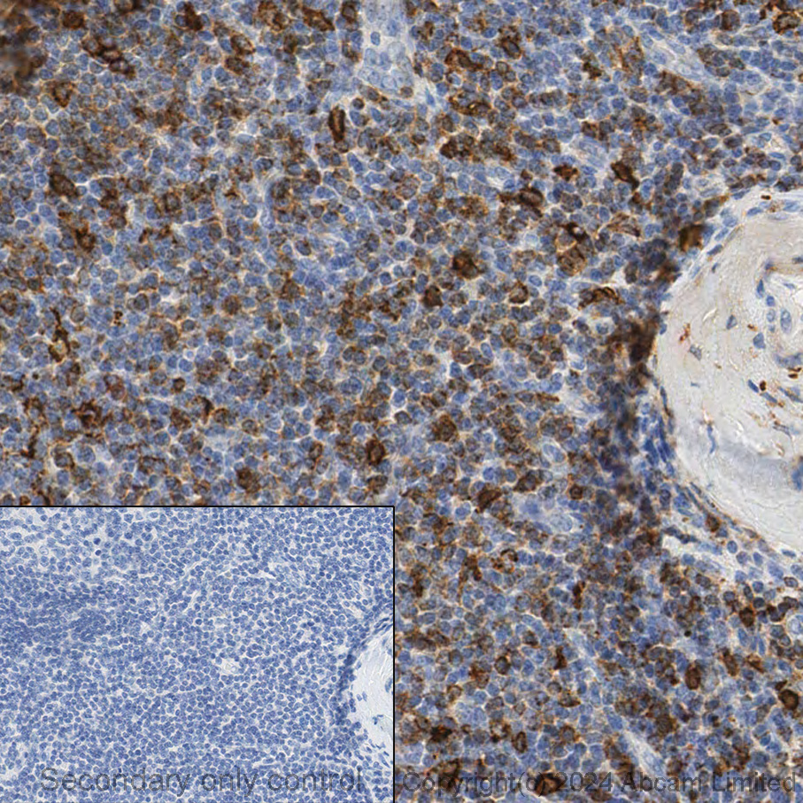 Immunohistochemistry (Formalin/PFA-fixed paraffin-embedded sections) - Anti-HLA-DR antibody [TAL 1B5] - BSA and Azide free (AB176408), expandable thumbnail