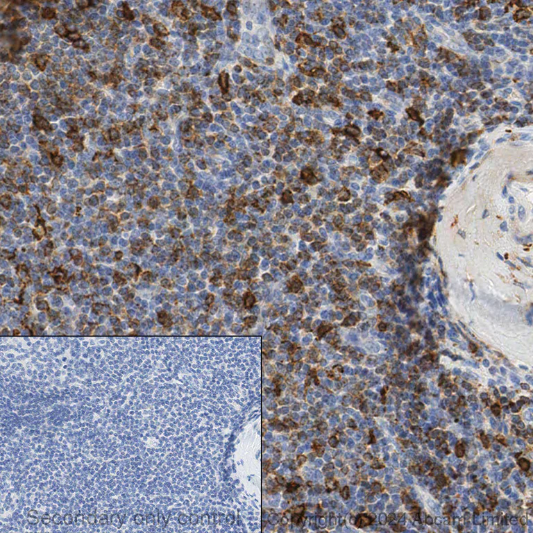 Immunohistochemistry (Formalin/PFA-fixed paraffin-embedded sections) - Anti-HLA-DR antibody [TAL 1B5] - BSA and Azide free (AB176408)
