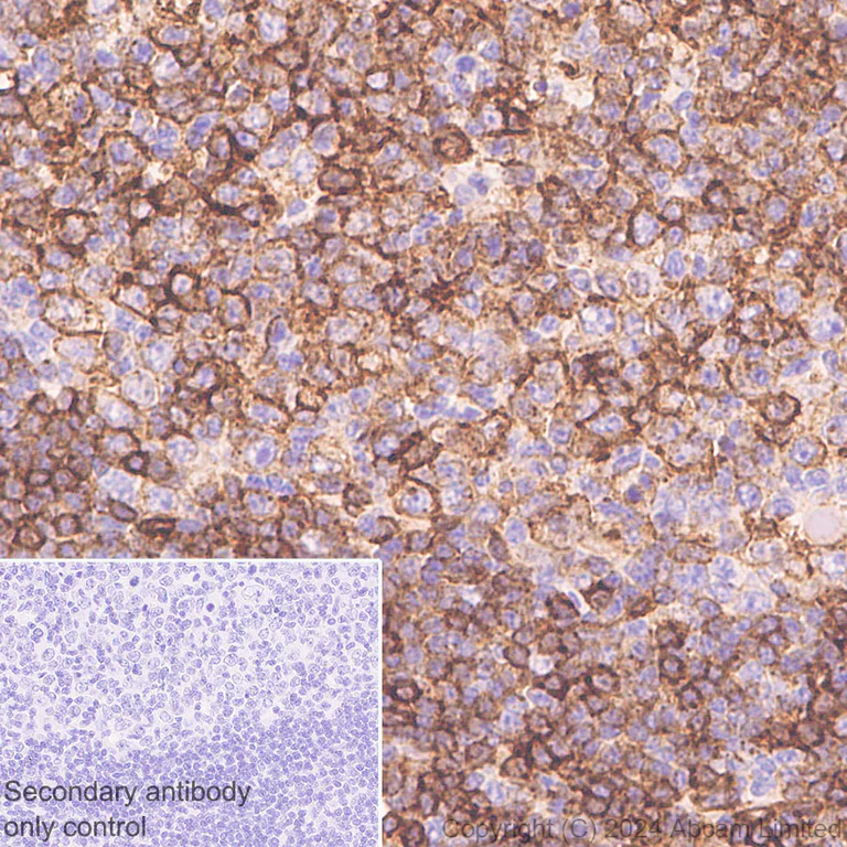 Immunohistochemistry (Formalin/PFA-fixed paraffin-embedded sections) - Anti-HLA DR + DP + DQ antibody [CR3/43] - BSA and Azide free (AB324796)