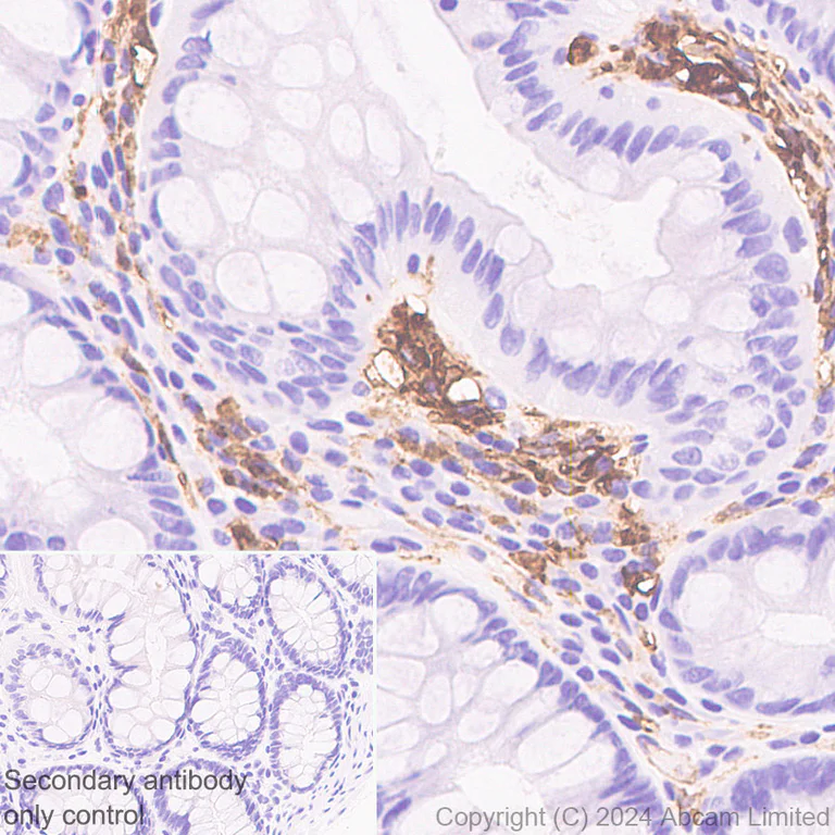 Immunohistochemistry (Formalin/PFA-fixed paraffin-embedded sections) - Anti-HLA DR + DP + DQ antibody [CR3/43] - BSA and Azide free (AB324796)