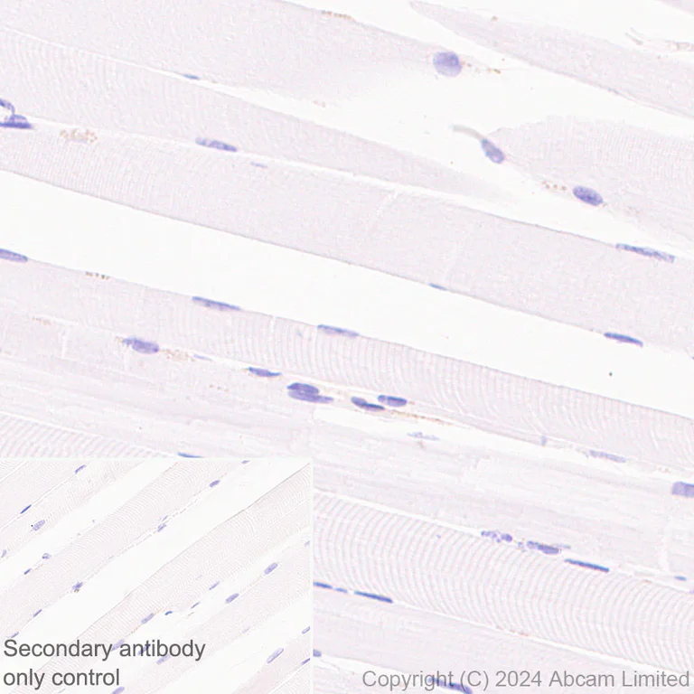 Immunohistochemistry (Formalin/PFA-fixed paraffin-embedded sections) - Anti-HLA DR + DP + DQ antibody [CR3/43] - BSA and Azide free (AB324796)