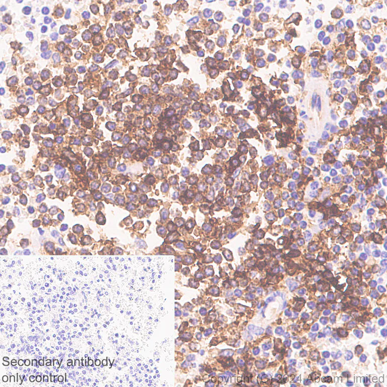 Immunohistochemistry (Formalin/PFA-fixed paraffin-embedded sections) - Anti-HLA DR + DP + DQ antibody [CR3/43] - BSA and Azide free (AB324796)