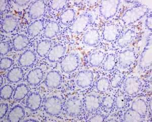 Immunohistochemistry (Formalin/PFA-fixed paraffin-embedded sections) - Anti-HLA-DRB antibody [EPR6148] (AB133578)