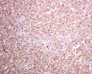 Immunohistochemistry (Formalin/PFA-fixed paraffin-embedded sections) - Anti-HLA-DRB antibody [EPR6148] (AB133578)
