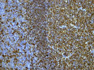 Immunohistochemistry (Formalin/PFA-fixed paraffin-embedded sections) - Anti-HLA-DRB antibody [EPR6148] (AB133578)