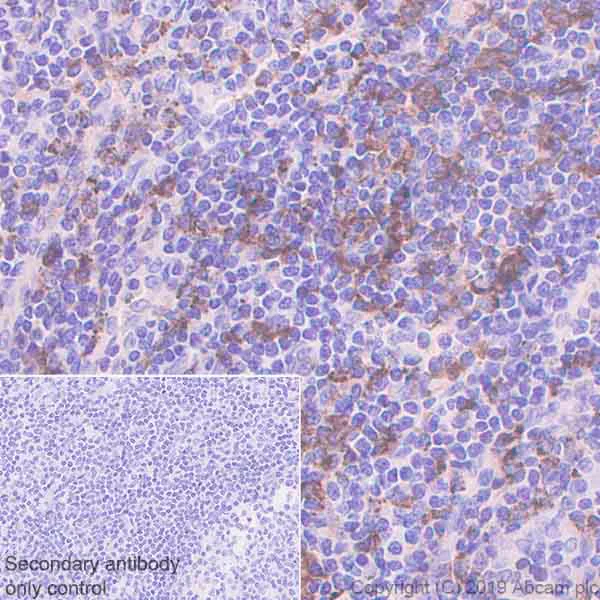 Immunohistochemistry (Formalin/PFA-fixed paraffin-embedded sections) - Anti-HLA-DRB antibody [EPR6148] (AB133578)