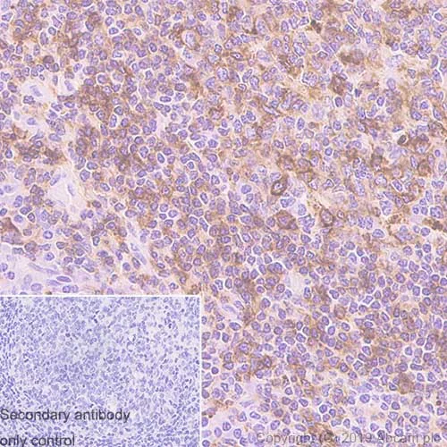 Immunohistochemistry (Formalin/PFA-fixed paraffin-embedded sections) - Anti-HLA DRB1 + HLA-DPB1 antibody [JS76] (AB241560)