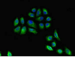 Immunocytochemistry/ Immunofluorescence - Anti-HLA DRB3 antibody (AB236950)