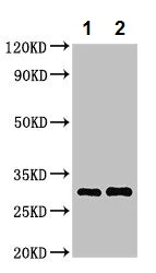 Western blot - Anti-HLA DRB3 antibody (AB236950)