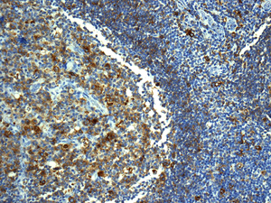 Immunohistochemistry (Formalin/PFA-fixed paraffin-embedded sections) - Anti-HLA-DRB4 antibody [EPR7182] (AB140612), expandable thumbnail