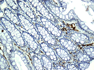 Immunohistochemistry (Formalin/PFA-fixed paraffin-embedded sections) - Anti-HLA-DRB4 antibody [EPR7182] (AB140612), expandable thumbnail