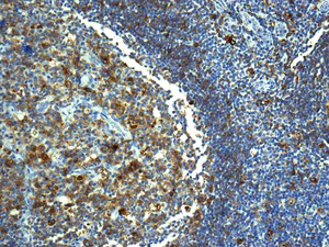 Immunohistochemistry (Formalin/PFA-fixed paraffin-embedded sections) - Anti-HLA-DRB4 antibody [EPR7182] - BSA and Azide free (AB248902)
