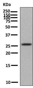 Western blot - Anti-HLA-DRB4 antibody [EPR7182] - BSA and Azide free (AB248902)