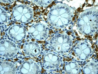 Immunohistochemistry (Formalin/PFA-fixed paraffin-embedded sections) - Anti-HLA-DRB4 antibody [EPR7183] (AB126767)