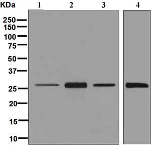 Western blot - Anti-HLA-DRB4 antibody [EPR7183] (AB126767)