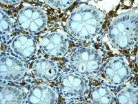 Immunohistochemistry (Formalin/PFA-fixed paraffin-embedded sections) - Anti-HLA-DRB4 antibody [EPR7183] - BSA and Azide free (AB248175)