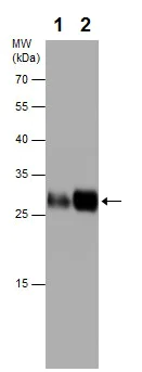 Western blot - Anti-HLA DRB5 antibody (AB226777)