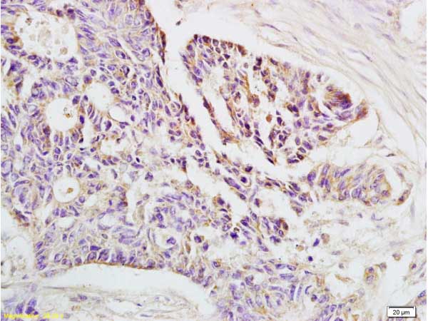 Immunohistochemistry (Formalin/PFA-fixed paraffin-embedded sections) - Anti-HLA E antibody (AB203082), expandable thumbnail