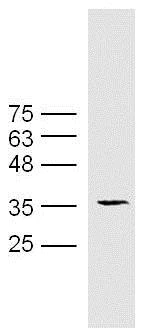 Western blot - Anti-HLA E antibody (AB203082)