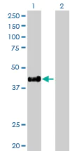 Western blot - Anti-HLA E antibody (AB88090)