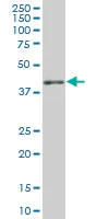 Western blot - Anti-HLA E antibody (AB88090)