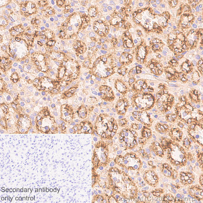 Immunohistochemistry (Formalin/PFA-fixed paraffin-embedded sections) - Anti-HLA E antibody [EPR25300-104] (AB300553)