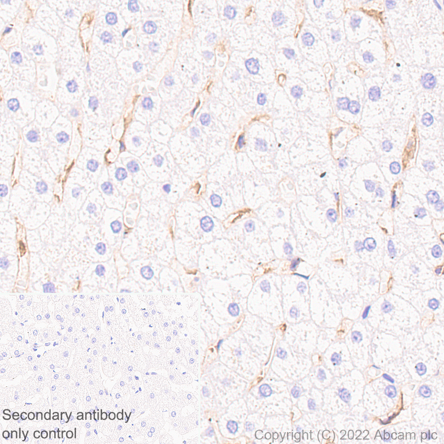 Immunohistochemistry (Formalin/PFA-fixed paraffin-embedded sections) - Anti-HLA E antibody [EPR25300-104] (AB300553)