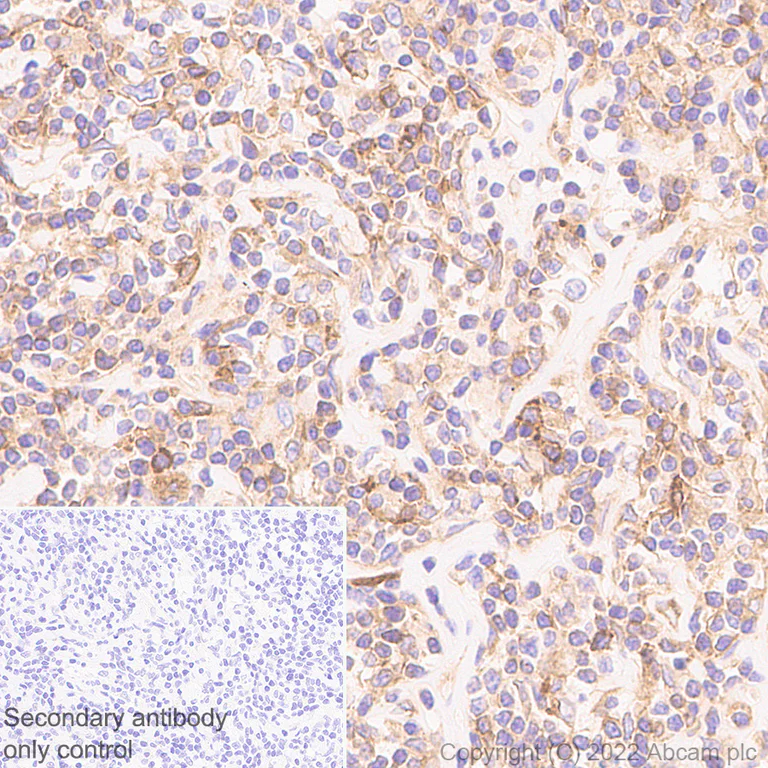 Immunohistochemistry (Formalin/PFA-fixed paraffin-embedded sections) - Anti-HLA E antibody [EPR25300-104] (AB300553)